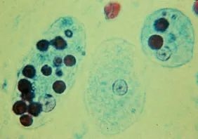 这种每年感染5000万人的寄生虫：科学已经知道它对人体做了什么
